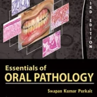 ESSENTIALS OF ORAL PATHOLOGY